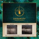 Indulekha Svetakutaja Ayurvedic Hair Oil 100 ml|Ayurvedic Medicinal oil for dandruff treatment with Svetakutaja-Comb Applicator Bottle for Men & Women grocery