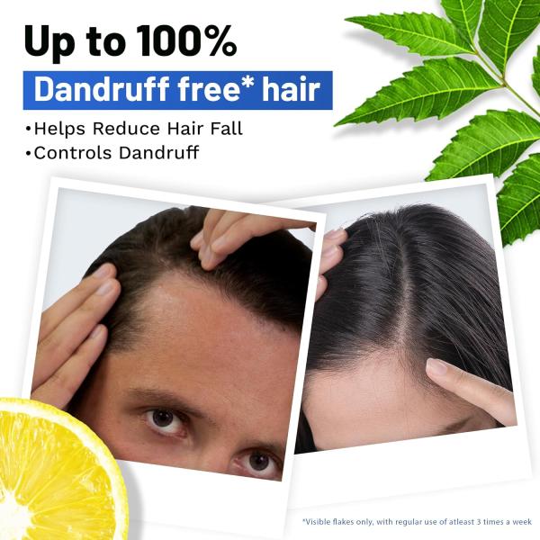 SESA Ayurvedic Anti Dandruff Shampoo With Neem, Lemon Helps Reduce Hairfall Controls Dandruff, 500Ml grocery