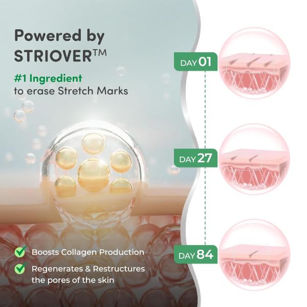 Mylo Care Stretch Marks Combo (Stretch Mark Oil - 100 ml, Stretch Marks Cream - 100 ml) |Stretch Marks removal for women